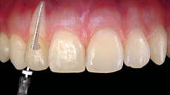 GOE - Ortodontia no Santo Agostinho - BH - Implantes Dentrios e Prteses  no Santo Agostinho - BH